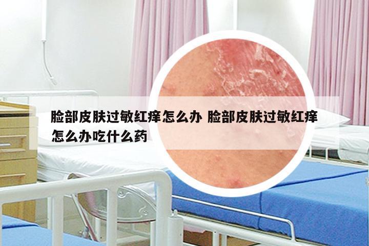 脸部皮肤过敏红痒怎么办 脸部皮肤过敏红痒怎么办吃什么药