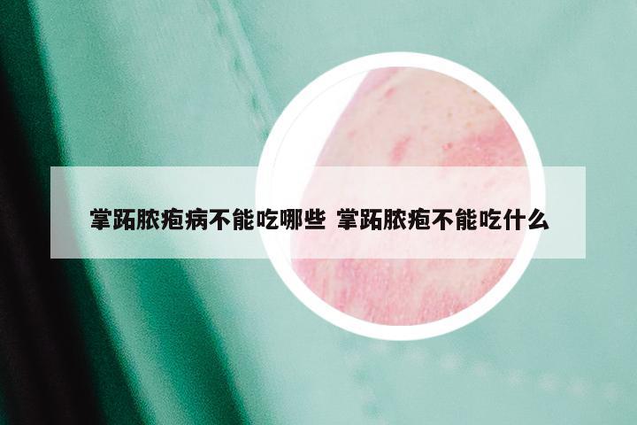掌跖脓疱病不能吃哪些 掌跖脓疱不能吃什么