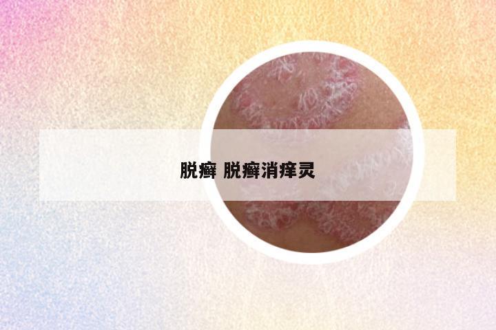 脱癣 脱癣消痒灵
