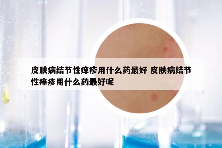 皮肤病结节性痒疹用什么药最好 皮肤病结节性痒疹用什么药最好呢