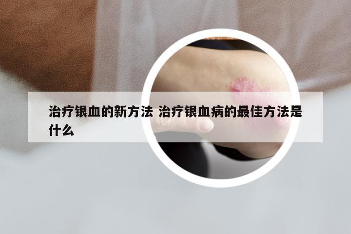 治疗银血的新方法 治疗银血病的最佳方法是什么