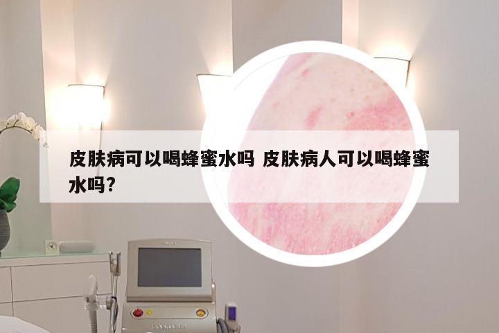 皮肤病可以喝蜂蜜水吗 皮肤病人可以喝蜂蜜水吗?