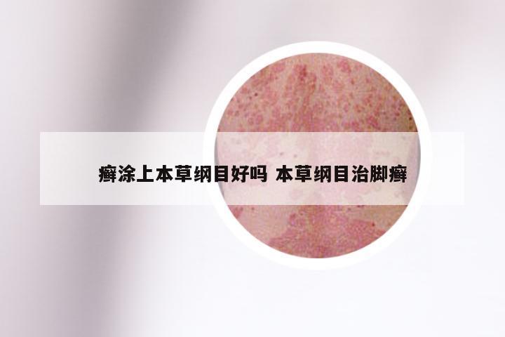 癣涂上本草纲目好吗 本草纲目治脚癣