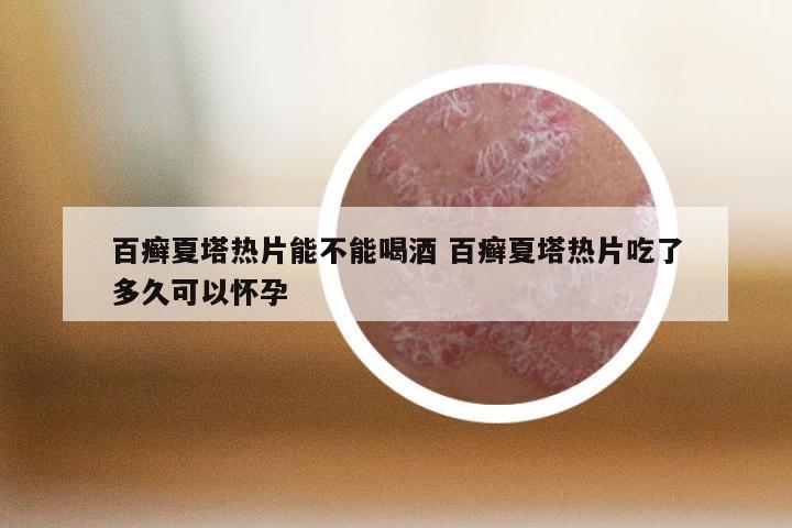 百癣夏塔热片能不能喝酒 百癣夏塔热片吃了多久可以怀孕