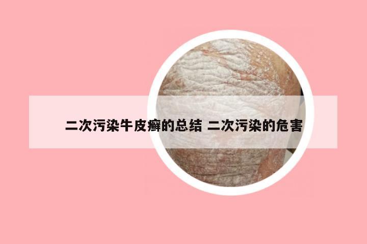 二次污染牛皮癣的总结 二次污染的危害