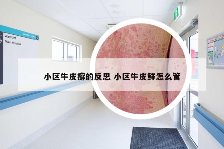 小区牛皮癣的反思 小区牛皮鲜怎么管
