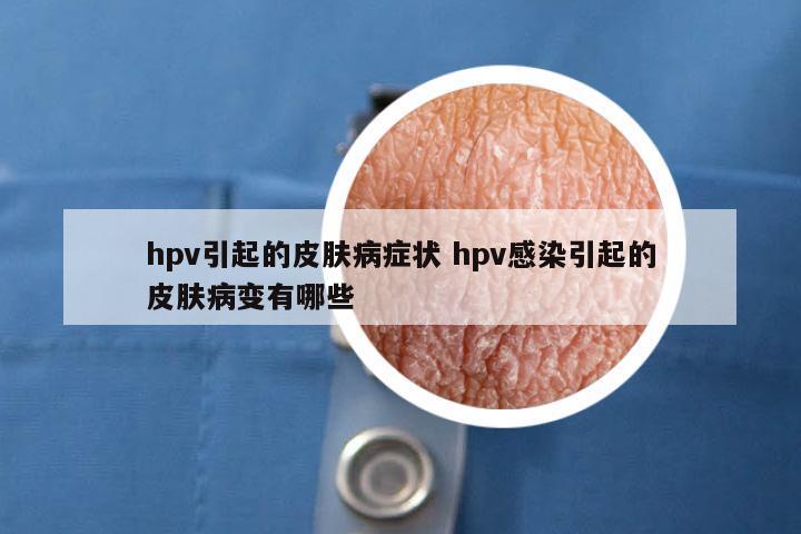 hpv引起的皮肤病症状 hpv感染引起的皮肤病变有哪些