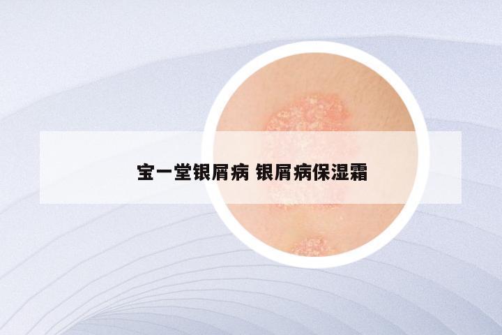 宝一堂银屑病 银屑病保湿霜