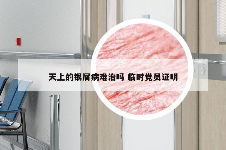 天上的银屑病难治吗 临时党员证明