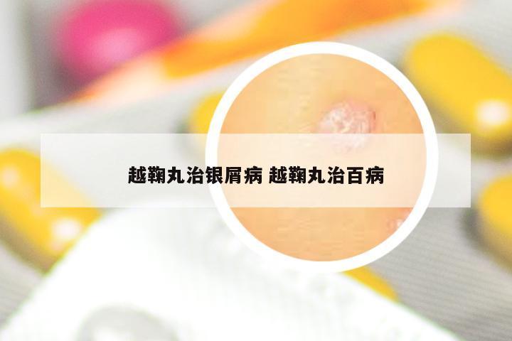 越鞠丸治银屑病 越鞠丸治百病