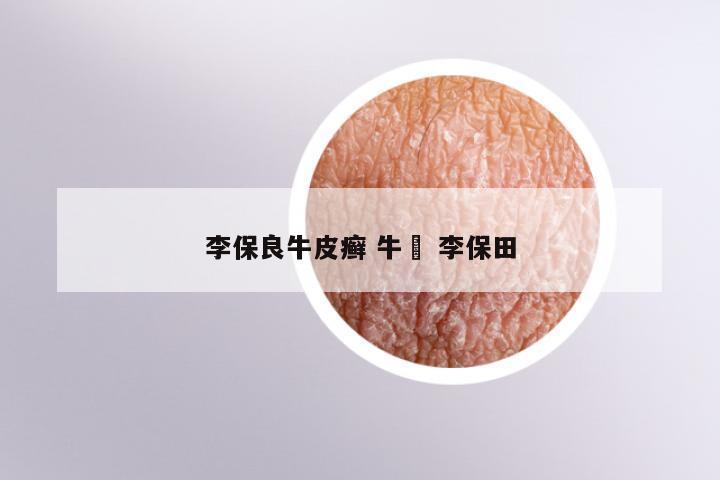 李保良牛皮癣 牛犇 李保田