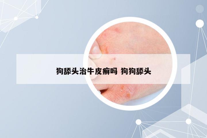 狗舔头治牛皮癣吗 狗狗舔头