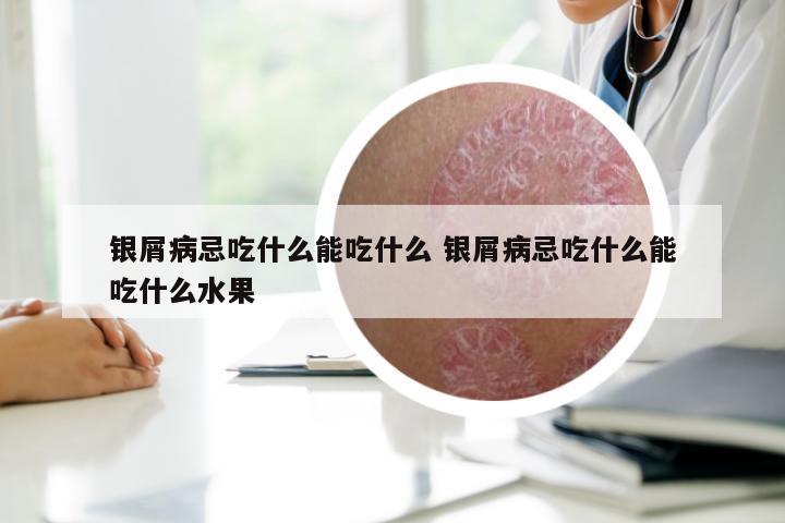 银屑病忌吃什么能吃什么 银屑病忌吃什么能吃什么水果