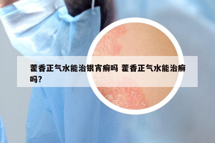 藿香正气水能治银宵癣吗 藿香正气水能治癣吗?