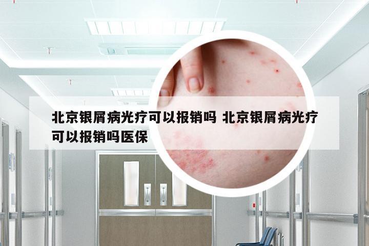 北京银屑病光疗可以报销吗 北京银屑病光疗可以报销吗医保