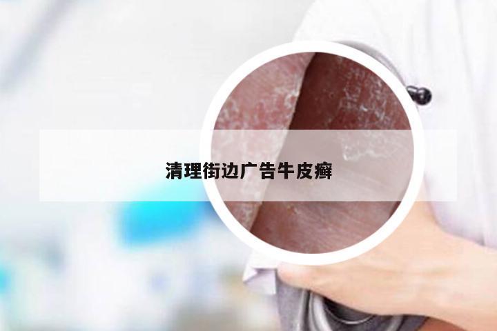 清理街边广告牛皮癣