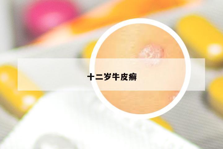十二岁牛皮癣