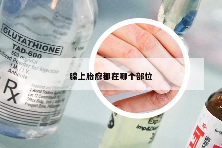 腺上胎癣都在哪个部位