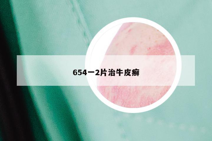 654一2片治牛皮癣