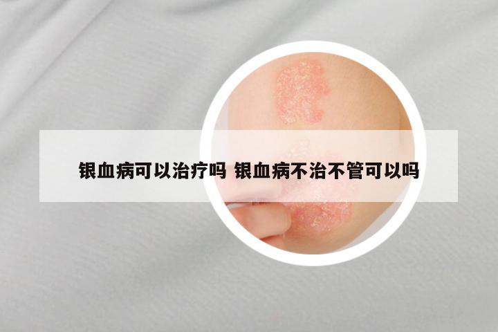 银血病可以治疗吗 银血病不治不管可以吗