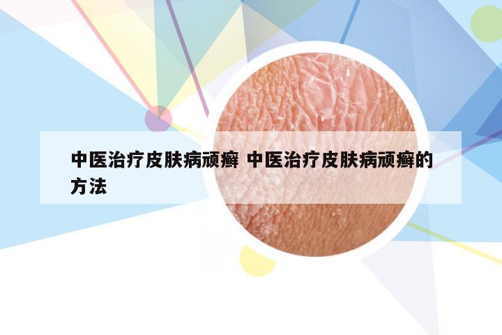 中医治疗皮肤病顽癣 中医治疗皮肤病顽癣的方法