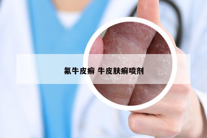 氟牛皮癣 牛皮肤癣喷剂