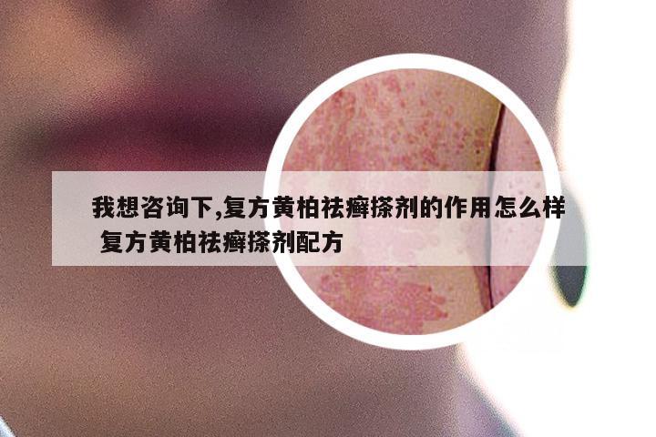 我想咨询下,复方黄柏祛癣搽剂的作用怎么样 复方黄柏祛癣搽剂配方