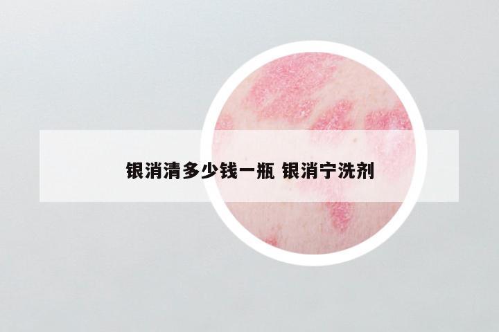 银消清多少钱一瓶 银消宁洗剂