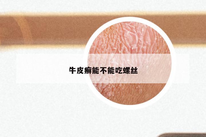 牛皮癣能不能吃螺丝