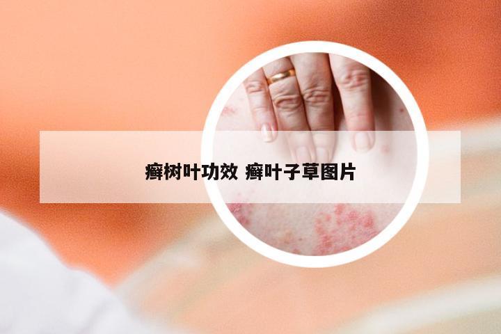 癣树叶功效 癣叶子草图片