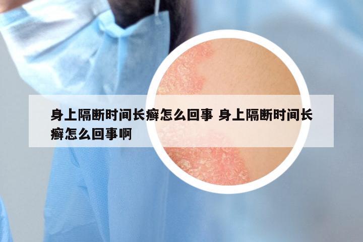 身上隔断时间长癣怎么回事 身上隔断时间长癣怎么回事啊