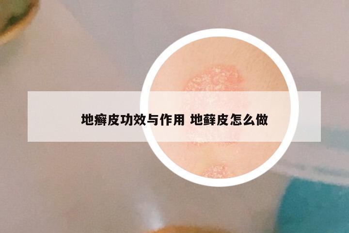 地癣皮功效与作用 地藓皮怎么做