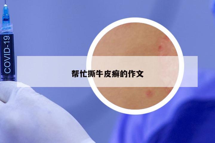 帮忙撕牛皮癣的作文