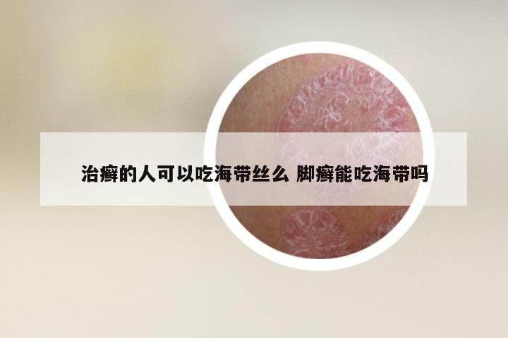 治癣的人可以吃海带丝么 脚癣能吃海带吗