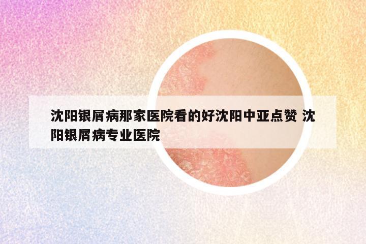 沈阳银屑病那家医院看的好沈阳中亚点赞 沈阳银屑病专业医院