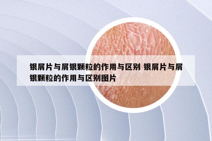 银屑片与屑银颗粒的作用与区别 银屑片与屑银颗粒的作用与区别图片