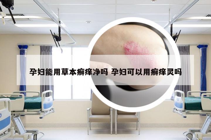 孕妇能用草本癣痒净吗 孕妇可以用癣痒灵吗