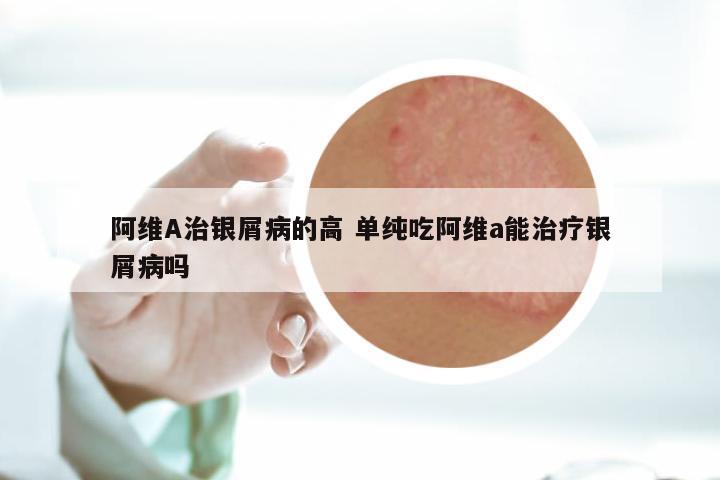 阿维A治银屑病的高 单纯吃阿维a能治疗银屑病吗