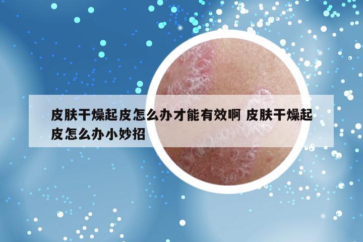 皮肤干燥起皮怎么办才能有效啊 皮肤干燥起皮怎么办小妙招