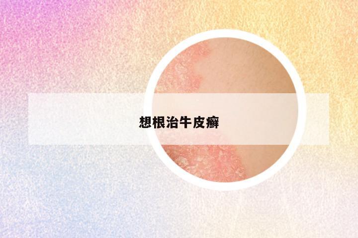 想根治牛皮癣