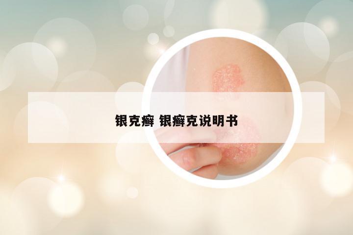 银克癣 银癣克说明书