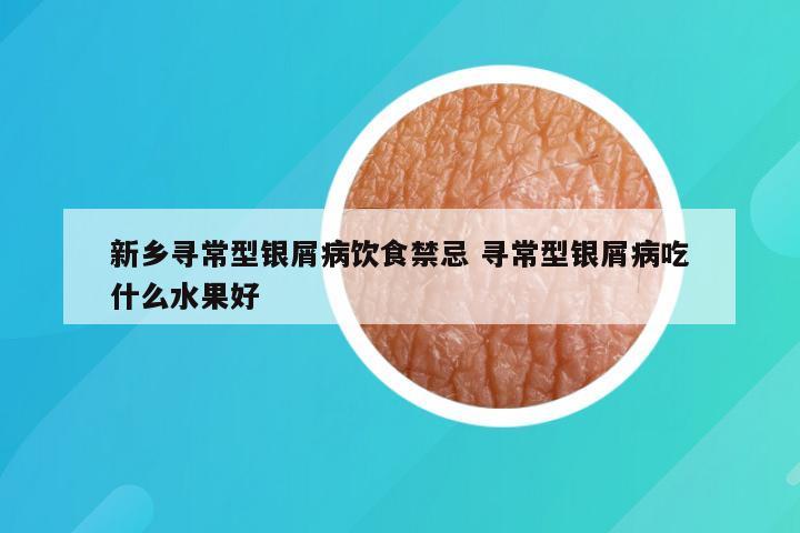 新乡寻常型银屑病饮食禁忌 寻常型银屑病吃什么水果好