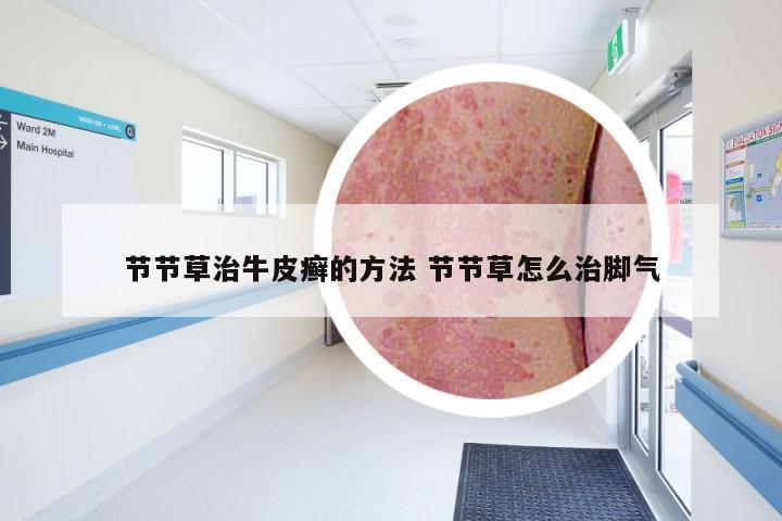节节草治牛皮癣的方法 节节草怎么治脚气