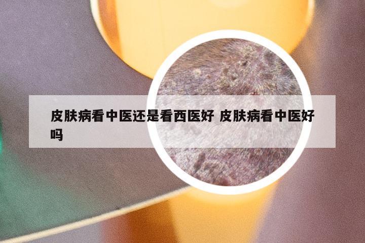 皮肤病看中医还是看西医好 皮肤病看中医好吗
