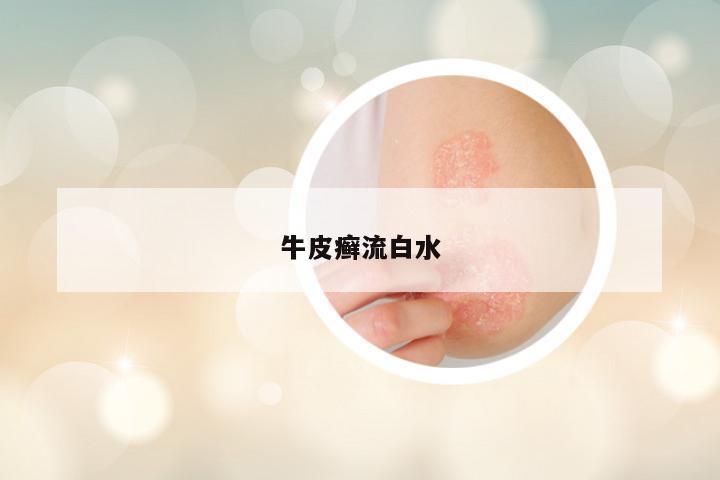 牛皮癣流白水