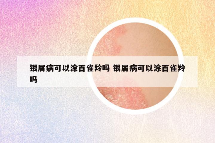 银屑病可以涂百雀羚吗 银屑病可以涂百雀羚吗