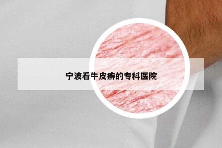 宁波看牛皮癣的专科医院