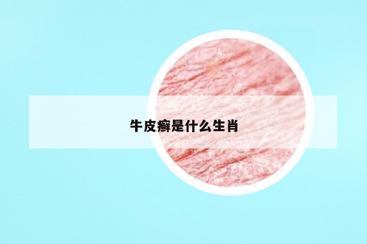 牛皮癣是什么生肖