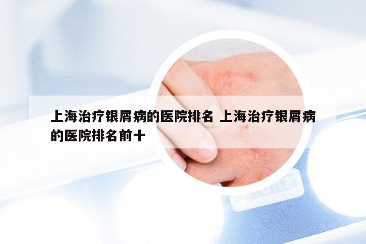 上海治疗银屑病的医院排名 上海治疗银屑病的医院排名前十