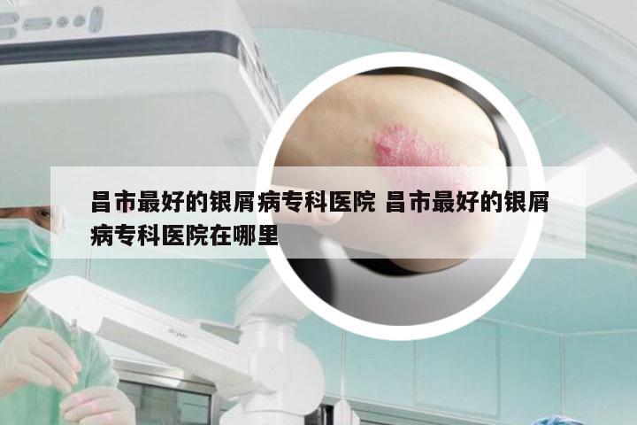 昌市最好的银屑病专科医院 昌市最好的银屑病专科医院在哪里